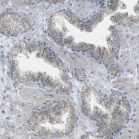 Anti-ZNF516 antibody produced in rabbit 