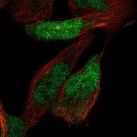 Anti-ZNF518A antibody produced in rabbit 