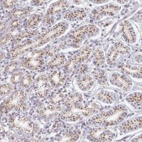 Anti-ZNF526 antibody produced in rabbit