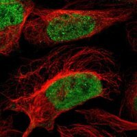 Anti-ZNF532 antibody produced in rabbit