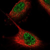 Anti-ZNF551 antibody produced in rabbit 