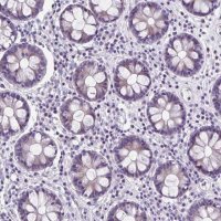 Anti-ZNF555 antibody produced in rabbit HPA053956-100UL
