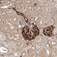 Anti-ZNF557 antibody produced in rabbit 