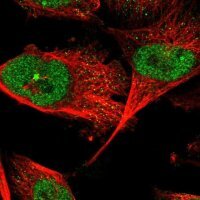 Anti-ZNF566 antibody produced in rabbit 
