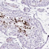 Anti-ZNF568 antibody produced in rabbit 