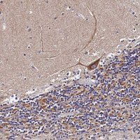 Anti-ZNF573 antibody produced in rabbit 