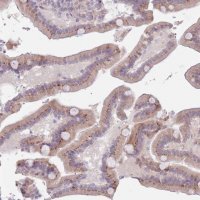 Anti-ZNF576 antibody produced in rabbit 