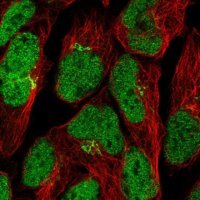 Anti-ZNF576 antibody produced in rabbit 