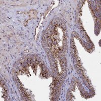 Anti-ZNF577 antibody produced in rabbit HPA041499-100UL