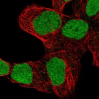 Anti-ZNF579 antibody produced in rabbit 