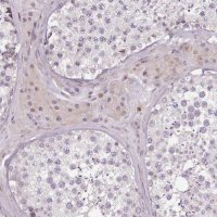 Anti-ZNF583 antibody produced in rabbit 