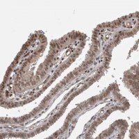Anti-ZNF592 antibody produced in rabbit 