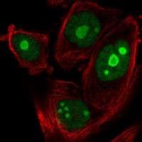 Anti-ZNF593 antibody produced in rabbit 