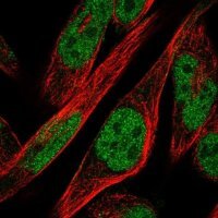 Anti-ZNF594 antibody produced in rabbit 