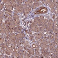 Anti-ZNF598 antibody produced in rabbit 