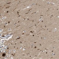 Anti-ZNF599 antibody produced in rabbit 