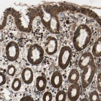 Anti-ZNF608 antibody produced in rabbit 
