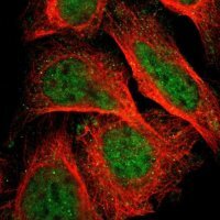 Anti-ZNF608 antibody produced in rabbit 