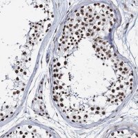 Anti-ZNF609 antibody produced in rabbit 