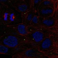 Anti-ZNF620 antibody produced in rabbit 