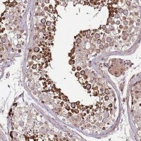 Anti-ZNF624 antibody produced in rabbit 