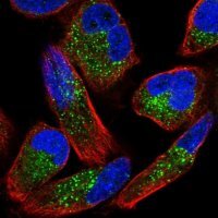 Anti-ZNF624 antibody produced in rabbit 