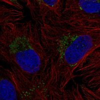 Anti-ZNF625 antibody produced in rabbit 