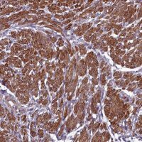Anti-ZNF626 antibody produced in rabbit 