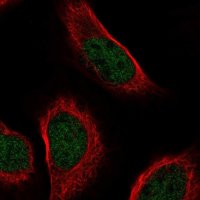 Anti-ZNF628 antibody produced in rabbit