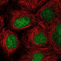 Anti-ZNF629 antibody produced in rabbit 