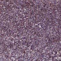 Anti-ZNF630 antibody produced in rabbit 