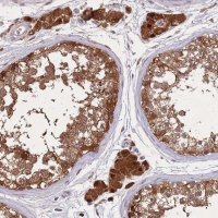 Anti-ZNF639 antibody produced in rabbit 