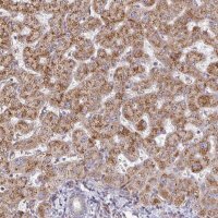 Anti-ZNF644 antibody produced in rabbit 