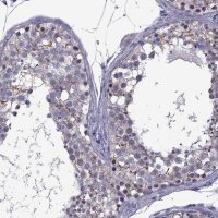 Anti-ZNF646 antibody produced in rabbit 