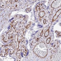 Anti-ZNF652 antibody produced in rabbit 