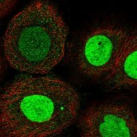 Anti-ZNF652 antibody produced in rabbit 