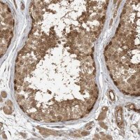 Anti-ZNF653 antibody produced in rabbit 