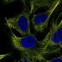 Anti-ZNF654 antibody produced in rabbit 