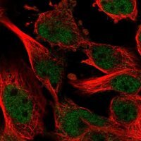 Anti-ZNF655 antibody produced in rabbit 
