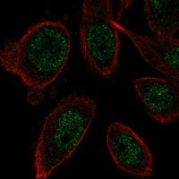 Anti-ZNF664 antibody produced in rabbit 