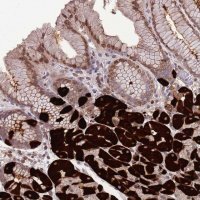 Anti-ZNF665 antibody produced in rabbit 