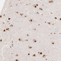 Anti-ZNF670 antibody produced in rabbit 