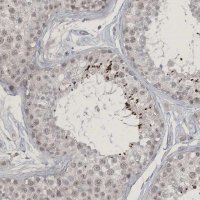 Anti-ZNF674 antibody produced in rabbit 