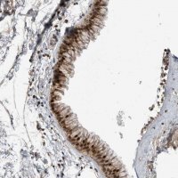 Anti-ZNF677 antibody produced in rabbit HPA024796-100UL