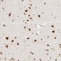 Anti-ZNF683 antibody produced in rabbit 
