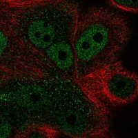 Anti-ZNF687 antibody produced in rabbit 
