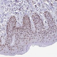 Anti-ZNF691 antibody produced in rabbit 
