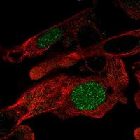 Anti-ZNF696 antibody produced in rabbit 