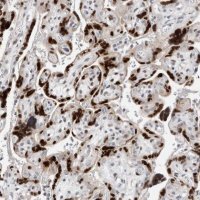 Anti-ZNF703 antibody produced in rabbit 