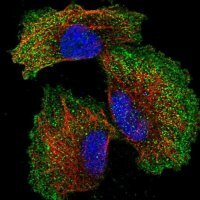 Anti-ZNF706 antibody produced in rabbit 